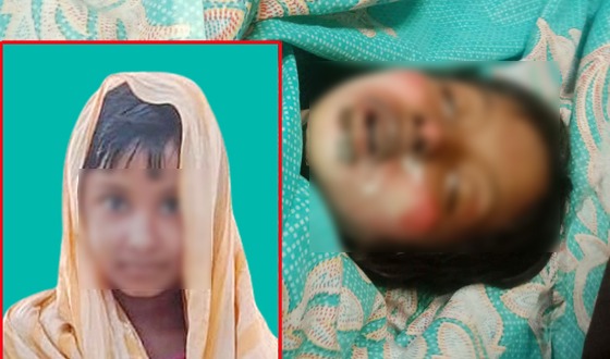 অসামাজিক কর্মকান্ডে রাজি না হওয়ায় কিশোরীকে পুড়িয়ে হত্যা