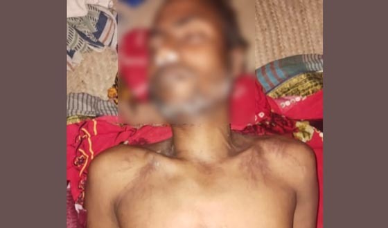 তানোরে বজ্রপাতে কৃষকের মৃত্যু