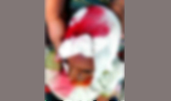 রায়গঞ্জে হত্যার উদ্দেশ্য করে ব্যাবসায়ী পিতা পুত্রকে মারধর, গ্রেফতার ১