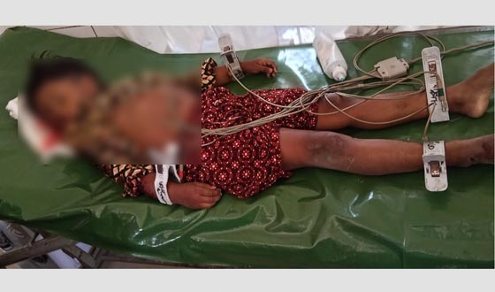 নানাবাড়ি বেড়াতে এসে নাতনির মৃত্যু