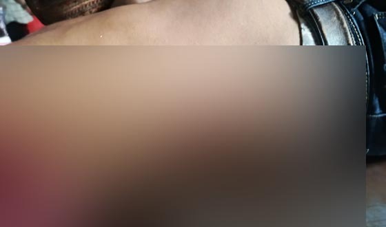 খুলনায় দুর্বৃত্তদের গুলিতে সাবেক ছাত্রদল নেতা সোহেল শেখ আহত