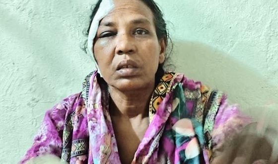 তানোরে দোকান ভাঙচুর ও লুটপাট বাঁধা দেয়ায় নারী পিটিয়ে আহত