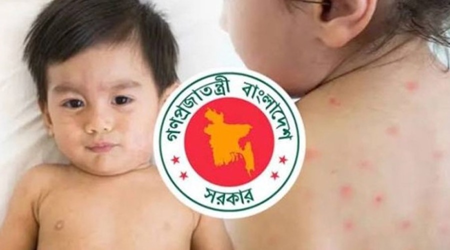 দেশে ২৪ ঘণ্টায় হামের উপসর্গ নিয়ে আরও ৩ শিশুর মৃত্যু