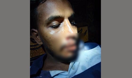 মসজিদ থেকে তুলে নিয়ে ছাত্রলীগ কর্মীর ওপর হামলা