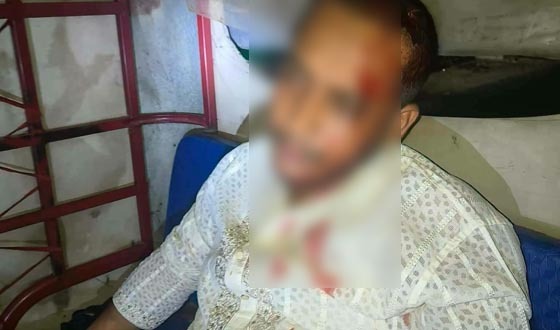 রাজশাহীতে এনসিপি নেতাকে গাছে বেঁধে কুপিয়ে জখম