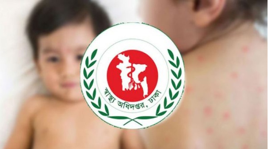 একদিনে হাম-উপসর্গে আরও ৯ শিশুর মৃত্যু
