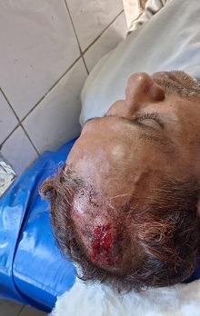 পুঠিয়ায় সাংবাদিক আরিফ সাদাত গুরুত্ব আহত