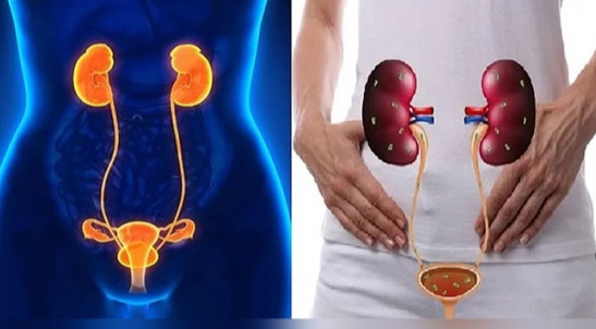 মূত্রনালির সংক্রমণ প্রতিরোধের উপায়