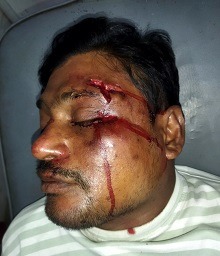 খুলনায় হাতুড়ি দিয়ে পিটিয়ে যুবকে রক্তাক্ত জখম