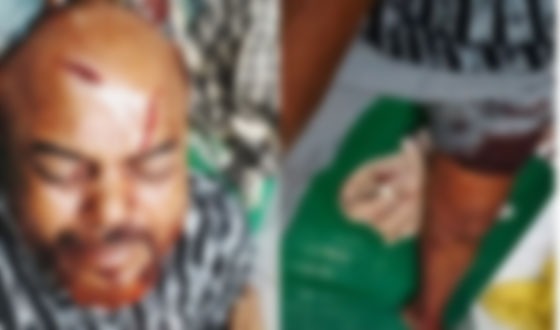 মতলব উত্তরে বিএনপির সাধারণ সম্পাদককে কুপিয়ে জখম