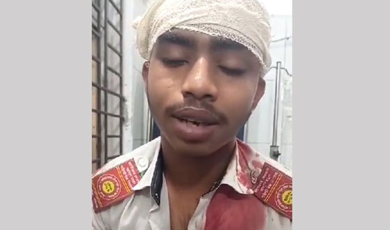 গজারিয়ায় তুচ্ছ ঘটনায় বিদ্যালয়ের সামনে শিক্ষার্থীদের মারামারি, আহত ৪