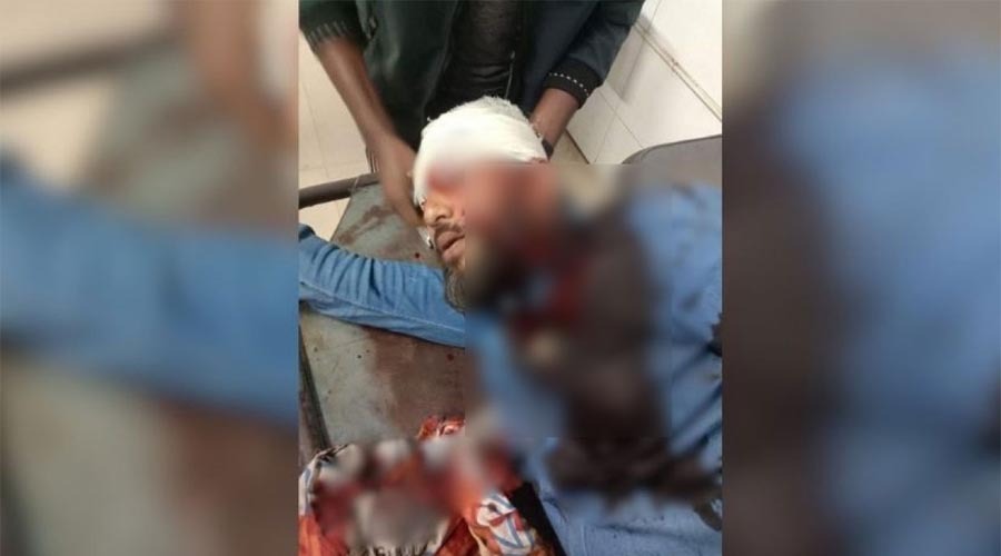 খুলনায় এনসিপি নেতাকে গুলি, অবস্থা আশঙ্কাজনক