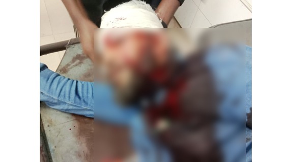 খুলনায় শ্রমিক শক্তির নেতাকে গুলি করে হত্যার চেষ্টা