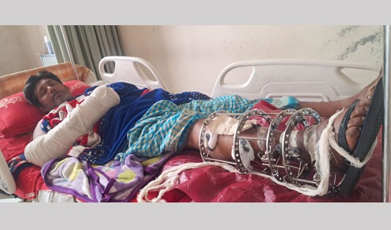 কালায়ে জামিন ছাড়াই প্রকাশ্যে ঘুরছে আসামীরা