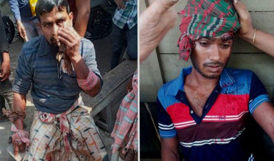 বেনাপোলে বিএনপির দুই গ্রুপের সংঘর্ষে আহত ৫