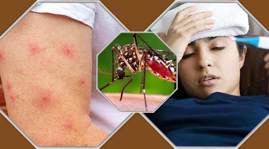 ডেঙ্গুতে ২৪ ঘণ্টায় ঝরলো ৪ প্রাণ, ভর্তি ৩১৯ জন