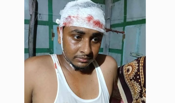 মুলাদীতে ছাত্রদল নেতার ওপর যুবলীগ-ছাত্রলীগ কর্মীদের হামলা, গ্রেপ্তার ১