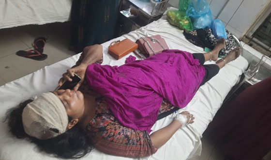 গজারিয়ায় প্রতিপক্ষের অতর্কিত হামলায় নারী আহত