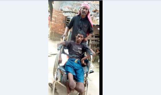 দু বেলা দু মুঠো ভাতের জন্য ভিক্ষা করছে বাক প্রতিবন্ধি নয়ন