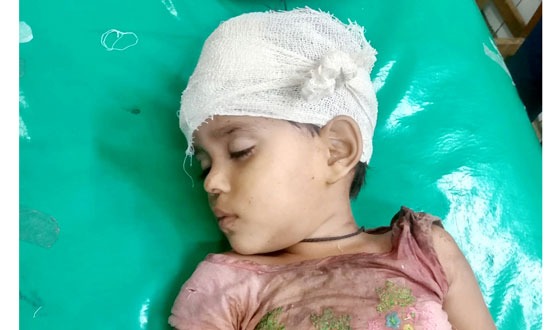 চার বছরের শিশুর ইট দিয়ে থেতলে দেয়া হয়েছে মাথা