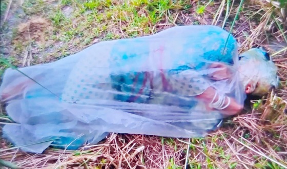 পলিথিনে মোড়ানো এসিড দগ্ধ নারীকে জীবিত উদ্ধার