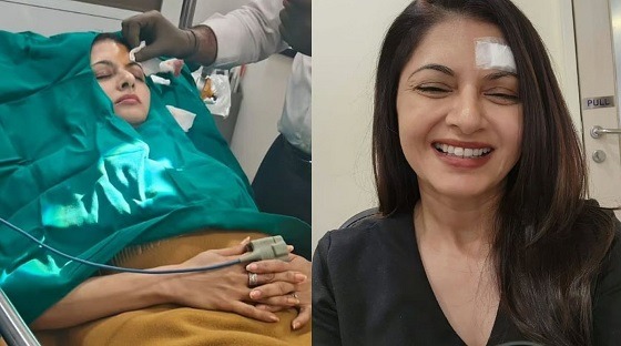 কপালে ১৩টি সেলাই পড়লো ভাগ্যশ্রীর