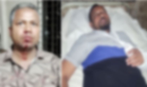 বিএনপি নেতার বিরুদ্ধে দলের দুই নেতাকে হাতুরি পেটার অভিযোগ