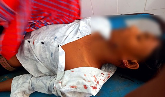 সাপাহারে সড়ক দুর্ঘটনায় মোটরসাইকেল চালক নিহত