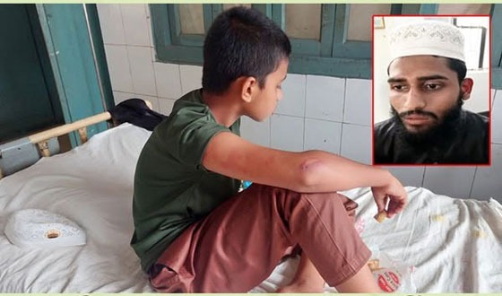 কালীগঞ্জে মাদরাসা শিক্ষার্থীকে পিটিয়ে আহত