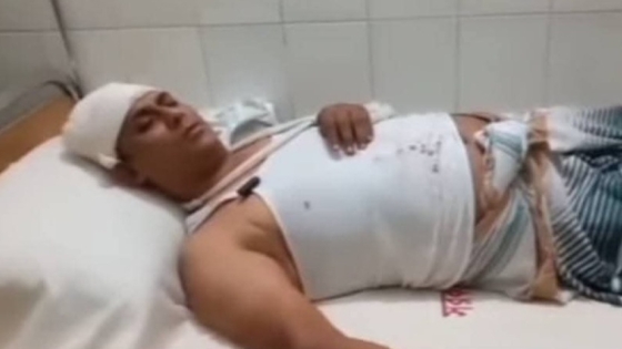 কাপাসিয়ায় মাদক কারবারিদের হামলায় ৪ পুলিশ সদস্য আহত