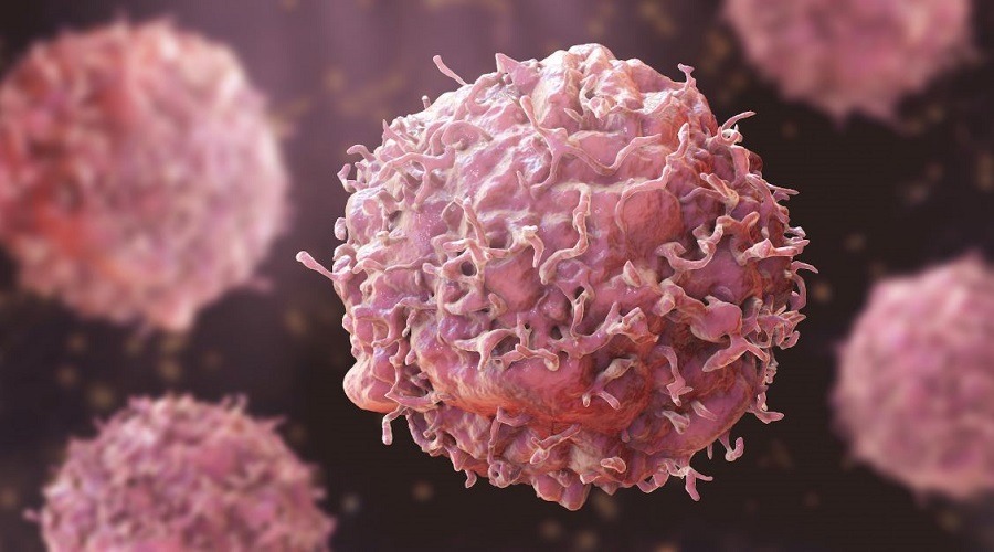 শরীরে ক্যানসারের ইঙ্গিত দেয় যেসব লক্ষণ