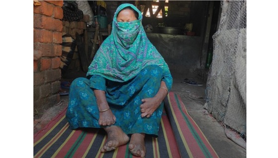 অবহেলা ও দেরিতেই বাড়ে কষ্ট, এখন মানুষ চিকিৎসা নিচ্ছে স্বতঃস্ফূর্তভাবে