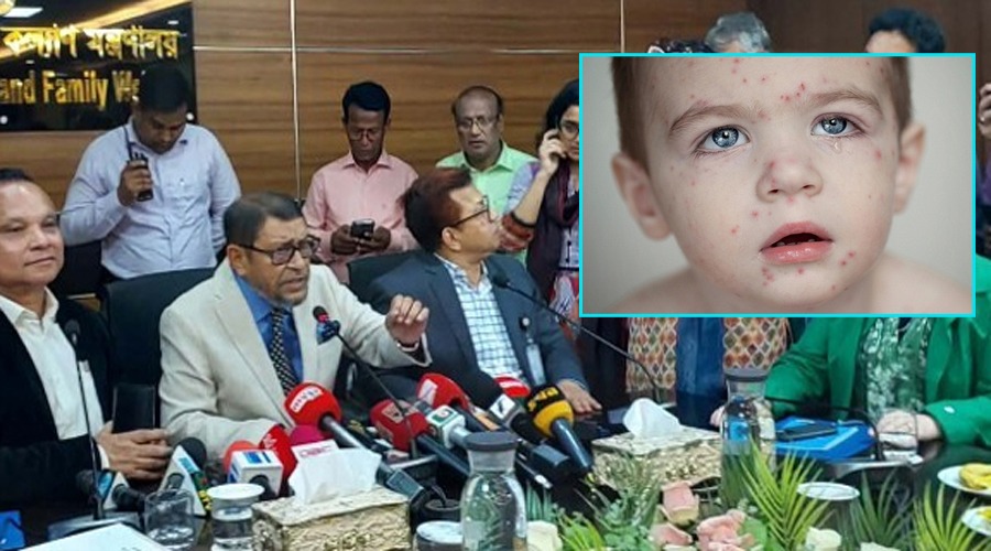আশঙ্কাজনক হারে বাড়ছে ব্যাধি হাম, রোববার থেকে টিকাদান কর্মসূচী শুরু