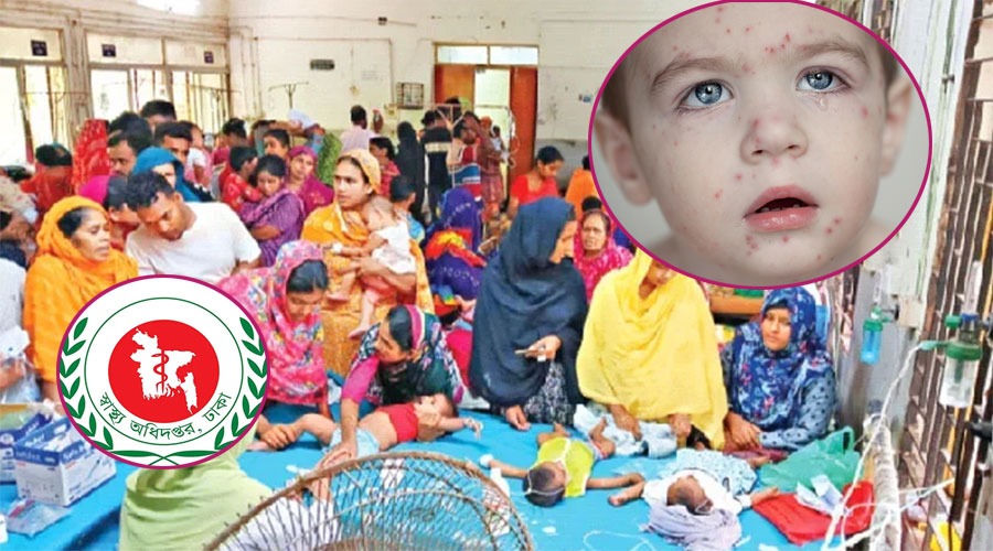 ২৪ ঘণ্টায় হামে ৬ জনের মৃত্যু, ভর্তি ৭৮৭ জন