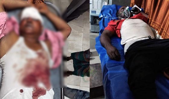 বেনাপোল বন্দরে ক্রেনের তার ছিঁড়ে শ্রমিকের মৃত্যু