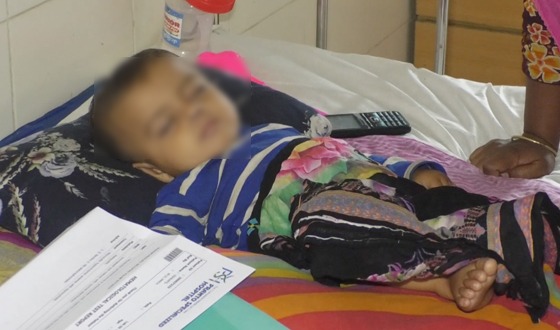 ময়মনসিংহে হামের উপসর্গ নিয়ে মারা গেলো আরও দুই শিশু