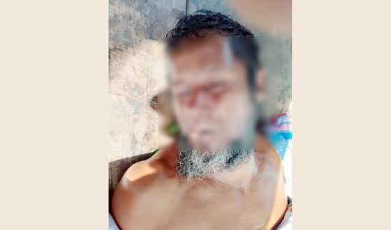 পলাশবাড়ীতে বিদ্যুৎস্পৃষ্টে এক ব্যক্তির মৃত্যু
