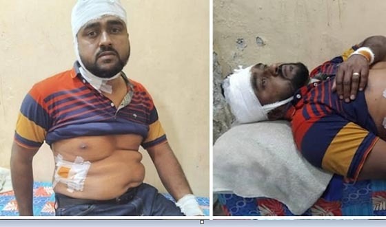 দৌলতপুরে বিএনপি কর্মীর উপর জামায়াতের হামলা, আহত ৫