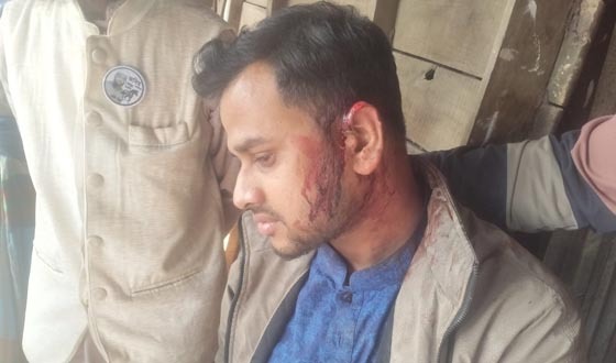 স্বতন্ত্র প্রার্থীর কর্মীর ওপর জামায়াত প্রার্থীর নেতাকর্মীদের হামলা