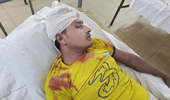 ফুলবাড়ীতে চাচার কোদালের আঘাতে ভাতিজা আহত