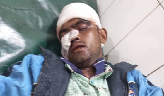 আত্রাইয়ে যুবককে হাতুড়ি দিয়ে পিটিয়ে জখম করে গাড়ী ছিনতাই