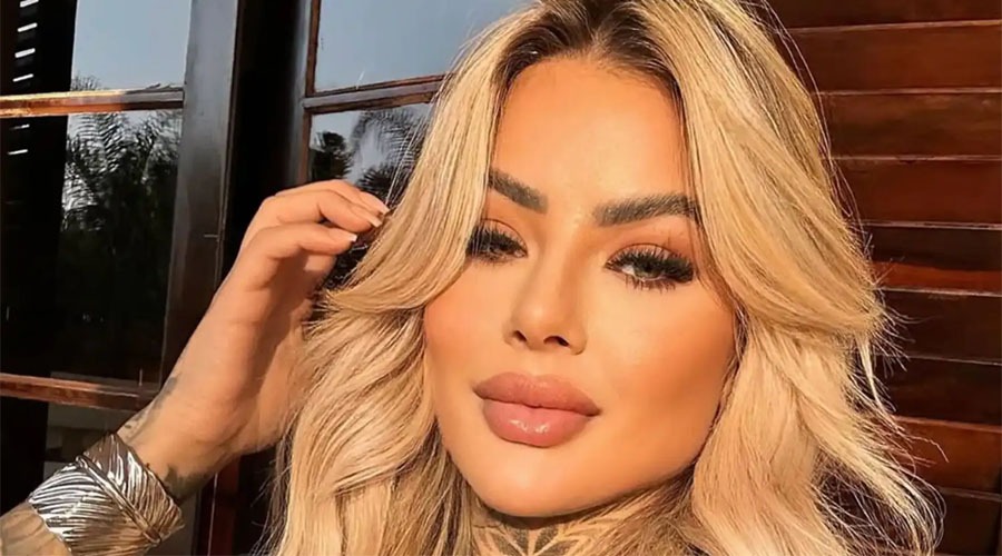 কসমেটিক সার্জারির জটিলতায় ঝরে গেল তরুণ মডেল বিয়াঙ্কা ডিয়াস