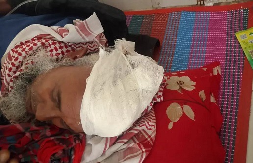 চাঁদাবাজি মামলার বাদীকে পিটিয়ে গুরুতর জখম