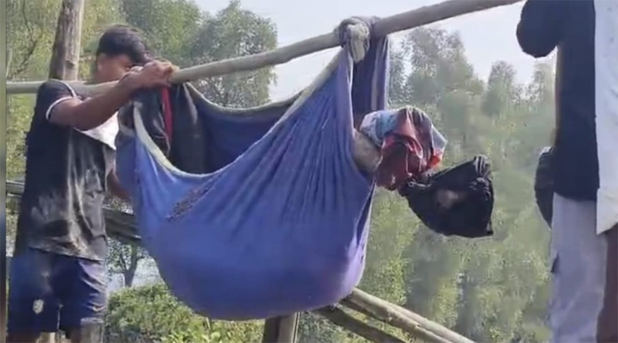 টেকনাফে আরাকান আর্মির পুঁতে রাখা মাইন বিস্ফোরণ, যুবকের পা বিচ্ছিন্ন