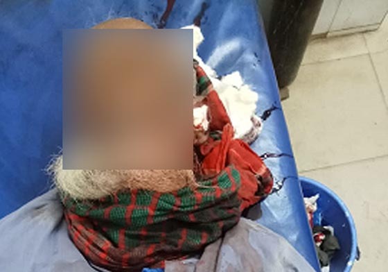 কলমাকান্দায় মোটরসাইকেল দুর্ঘটনায় নিহত ১