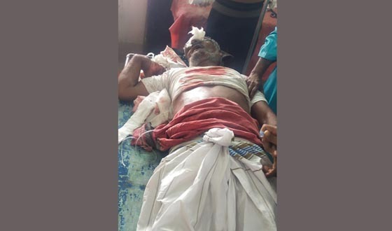 কলাপাড়ায় বাস চাপায় নিহত ১ , আহত ১