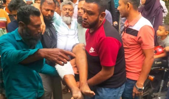 অভয়নগরে দুর্বৃত্তদের হামলায় আওয়ামী লীগ নেতা আহত