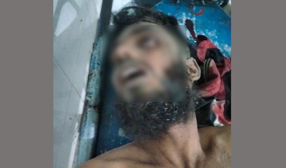 দিঘলিয়ায় সন্ত্রাসীদের গুলিতে ছিনতাইকারী নিহত, আহত ২