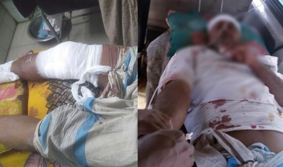 আওয়ামী লীগ নেতার হামলায় বিএনপির ১০ কর্মী আহত